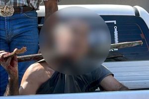 Paranaense tem estaca atravessada no pescoço e é internado em estado grave